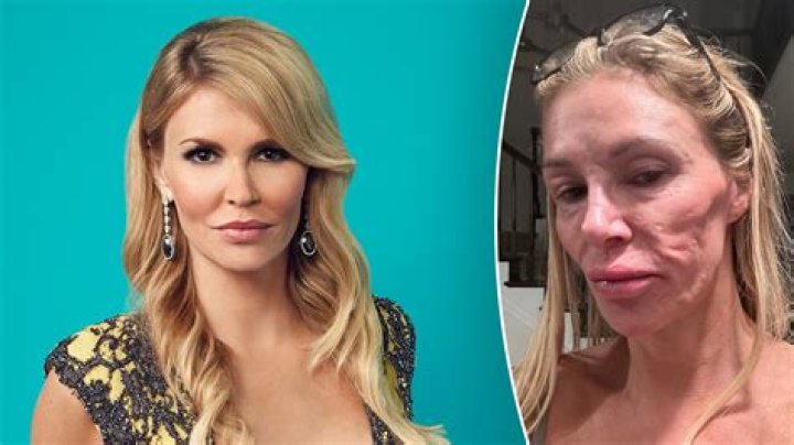 Brandi Glanville Drunk Wardrobe Malfunction — Star Responds To Twitter Attacks – Hollywood Life