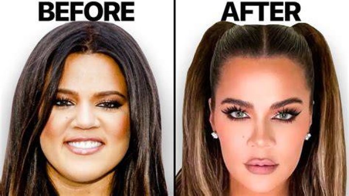 Khloe Kardashian’s Lips Look Bigger Than Ever In Throwback Pics From Her ‘Glam Days’