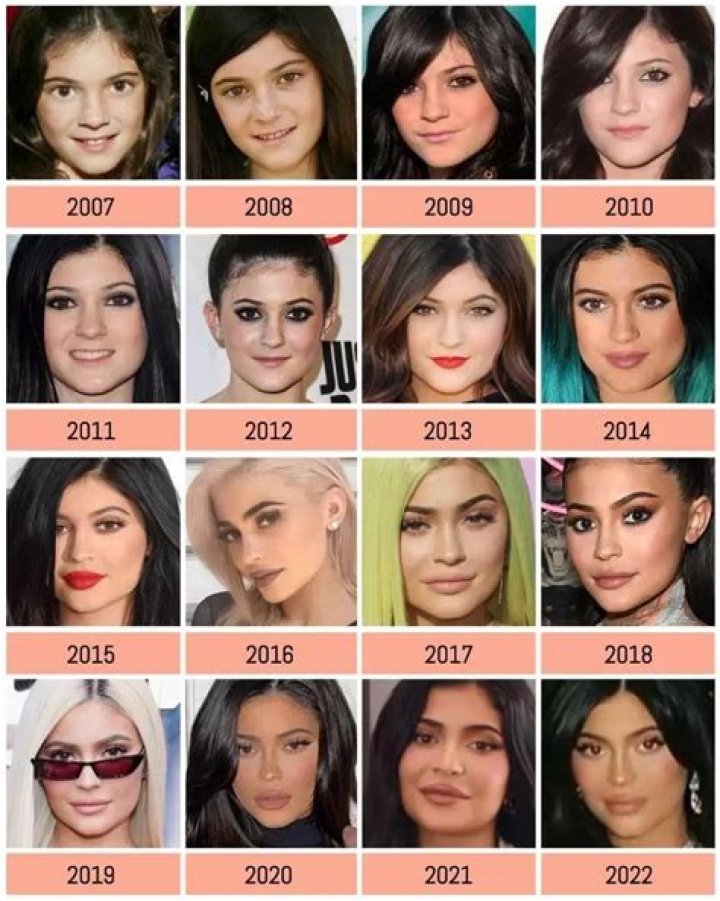 Kylie Jenner’s Beauty Evolution: Pics