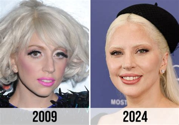 [PICS] Did Lady Gaga Get A Nose Job? Plastic Surgeon Speaks After ‘X Factor’ – Hollywood Life