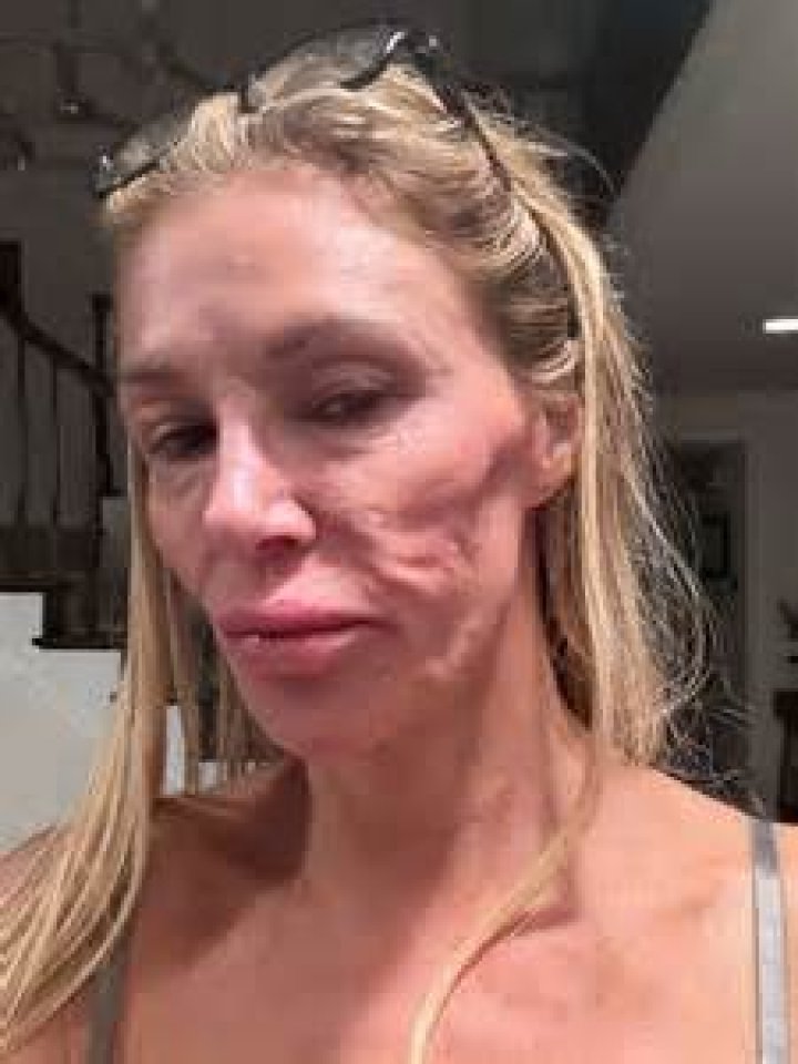 RHOBH’s Brandi Glanville Reveals She ‘Collapsed’ and Her Son ‘Had to Call 9-1-1 for Help’