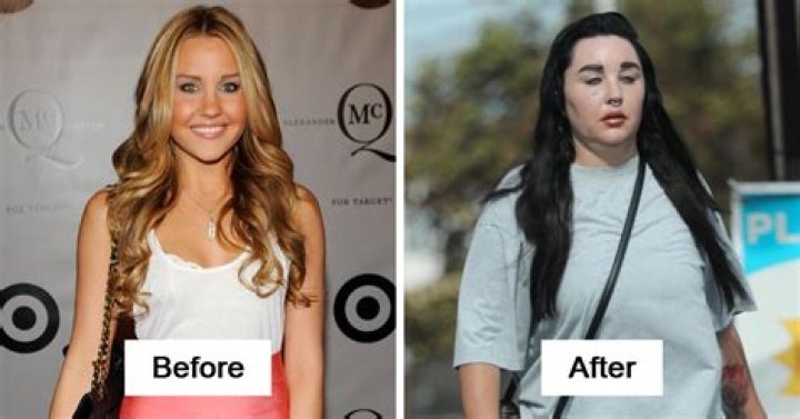 See Photos Of Their Transformations – Hollywood Life