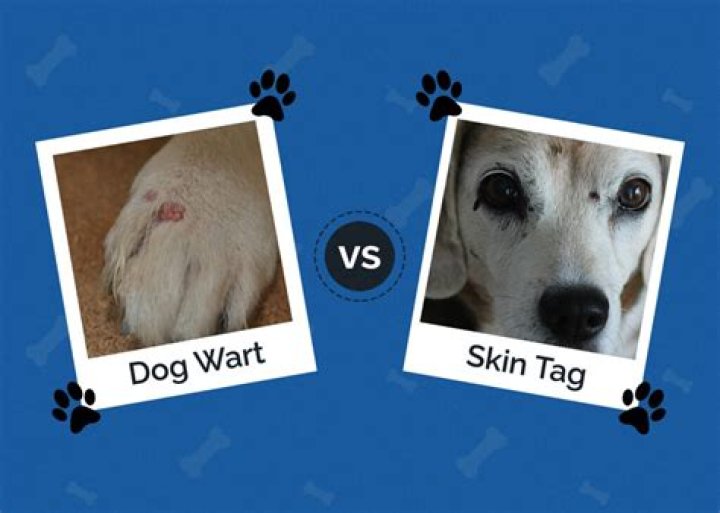Wart vs. Skin Tag: What’s The Difference?