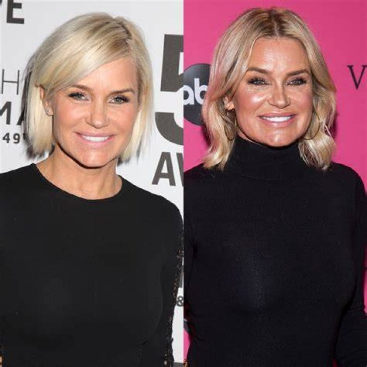 Yolanda Hadid, 55, Shows Off Her Flawless Body After Removing Breast Implants And Fillers